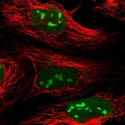 CMSS1 Antibody, Novus Biologicals:Antibodies:Primary Antibodies